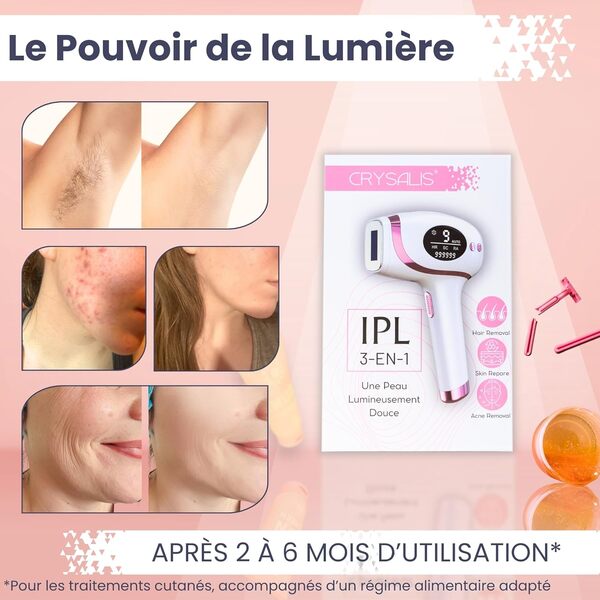 CRYSALIS Epilateur Lumiere Pulsee IPL Nouvelle Génération 3-en-1 – Épilation Durable, Anti-Acné et Soin de la Peau – Pour Visage & Corps, Femme/Homme – Appareil Électrique Multifonction