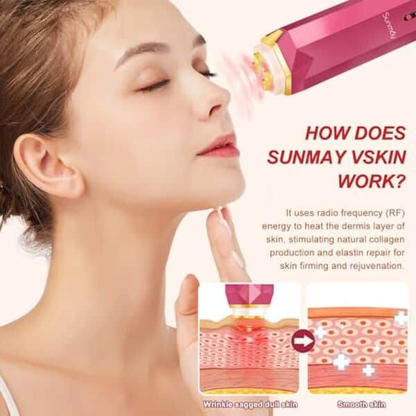 Explorez l'efficacité de l'appareil anti-âge VSkin de Sunmay : solutions beauté innovantes pour une peau rajeunie.